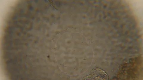 Bacteria Parasites and Worms in drinking Water under Microscope. nematode Wor Stock Footage 153024449
