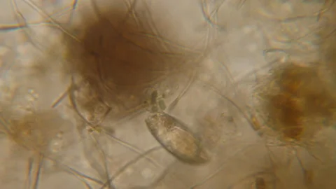 Bacteria Parasites and Worms in drinking Water under Microscope. nematode Wor Stock Footage 153024492