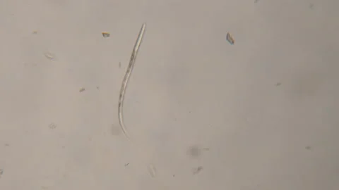 Bacteria Parasites and Worms in drinking Water under Microscope. nematode Wor Stock Footage 153024550