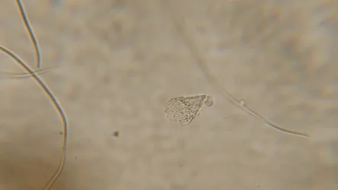 Bacteria Parasites and Worms in drinking Water under Microscope. nematode Wor Stock Footage 153024718