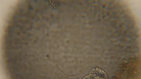 Bacteria Parasites and Worms in drinking Water under Microscope. nematode Wor Stock Footage 154542615