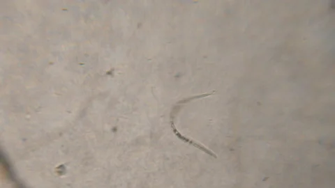 Bacteria Parasites and Worms in drinking... | Stock Video | Pond5