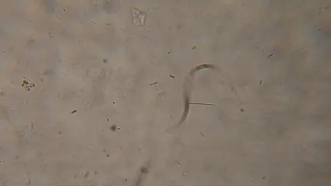 Bacteria Parasites and Worms in drinking Water under Microscope. nematode W.. Stock Footage 328352822