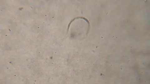 Bacteria Parasites and Worms in drinking Water under Microscope. nematode W.. Stockbeeldmateriaal 339300132