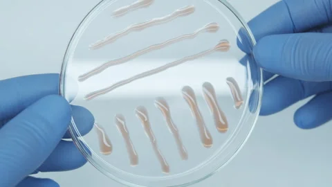 Bacteria on a petri dish Stock Footage 242804127