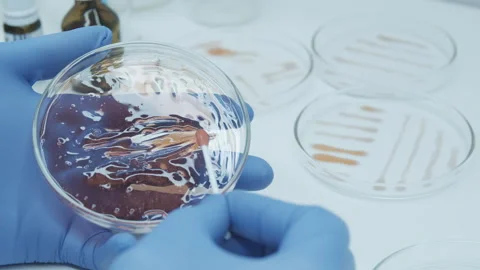 Bacteria on a petri dish Video stock 242806942