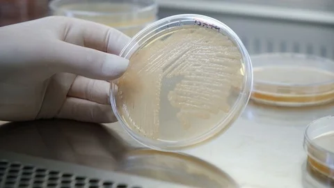 Bacteria  in plastic plate in laboratory Stock Footage 113196052
