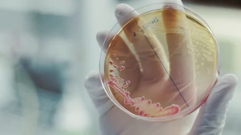 Bacteria on plate agar in laboratory Stock Footage 130122092