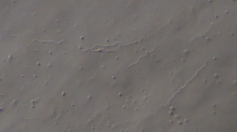 Bacteria (Spirochaetes) Stock Footage 64826701