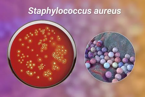 Bacteria Staphylococcus aureus, 3D illustration Illustrazione stock