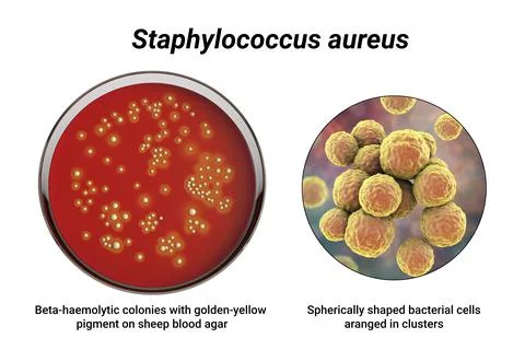 Bacteria Staphylococcus aureus, 3D illustration Illustrazione stock