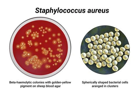 Bacteria Staphylococcus aureus, 3D illustration Stock Illustration