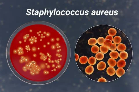 Bacteria Staphylococcus aureus, 3D illustration Illustrazione stock
