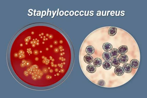 Bacteria Staphylococcus aureus, 3D illustration Illustrazione stock