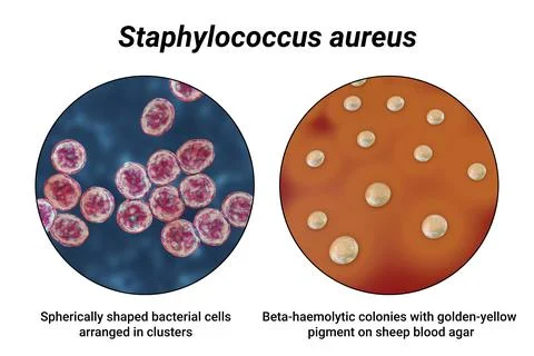 Bacteria Staphylococcus aureus, 3D illustration Stock Illustration