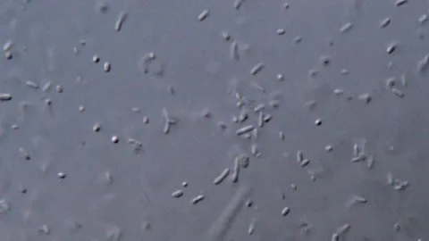 Bacteria under DIC microscope, 400x magnification 動画素材 317141152