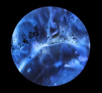Bacteria under the microscope background.  background  bacteria Stock Photos