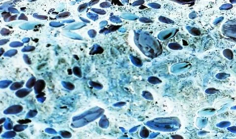 Bacteria under the microscope background.  background  bacteria Stock Photos