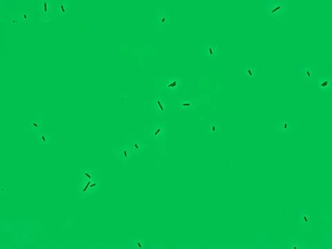 Bacteria under a microscope, E. coli Stock Photos