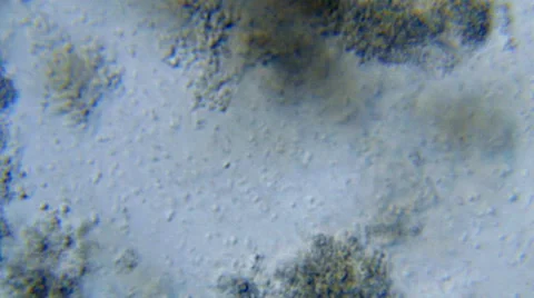 Bacteria under microscope Stock Footage