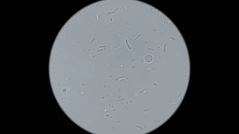 Bacteria under the microscope Stock Footage 88165021