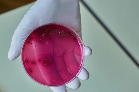 Bacterial colonies of E coli on medium plate hold in hand of scientist Stock Photos