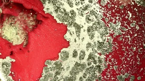 Bacterial colonies Stock Footage 122376664