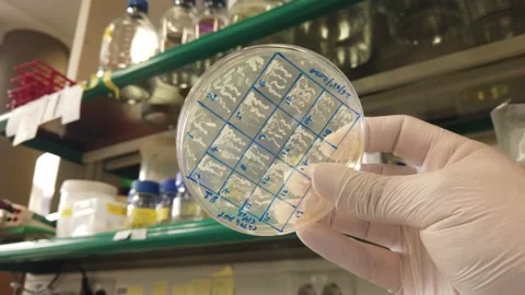 Bacterial colonies Stock Footage 132925108