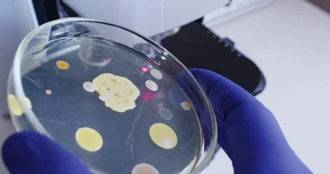 Bacterial colonies Stock Footage 310517565