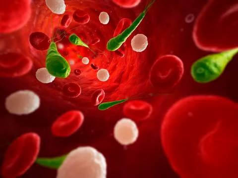 Bacterial infection, artwork Stock Illustration