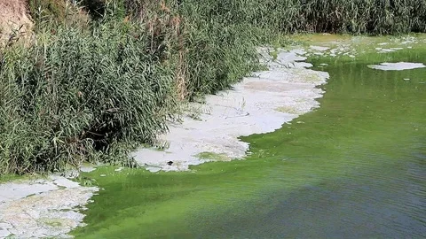 bacterial infection on the surface of a ... | Stock Video | Pond5