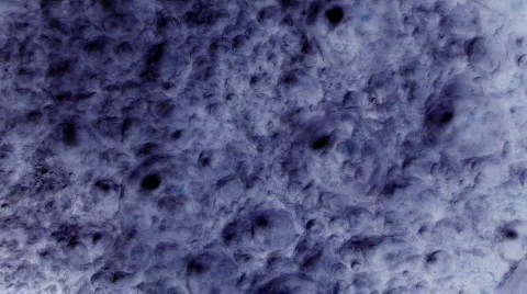 Bacterial Noise  스톡 동영상 285511