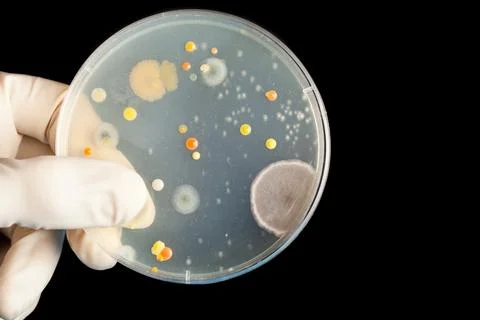 Bacterial pathogen colony on an agar streak plate in a medical , science la.. Stock Photos