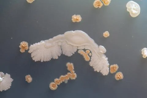 Bacterial pollution Photos