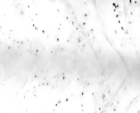 Bacteriana 스톡 동영상 103358