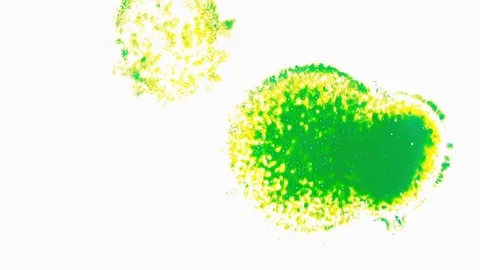 Bacterias breeding under microscope2 Stock Footage 77506151