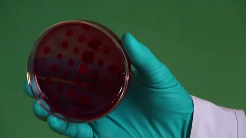 Bacteriologist examines the Endo petri dish on the green background Stock Footage 73337519