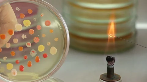 Bacteriologist heats  microbiological loop and touches colony Stock-Footage 60239453