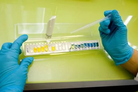  Bacteriology Laboratory of bacteriology. API system for the identificatio... Stock Photos
