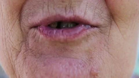 Bad And Rotten Teeth Stock Footage 77391077