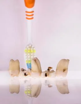 Bad teeth Stock Photos