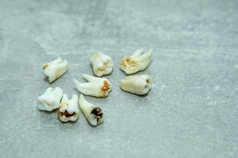 Bad teeth Stock Photos