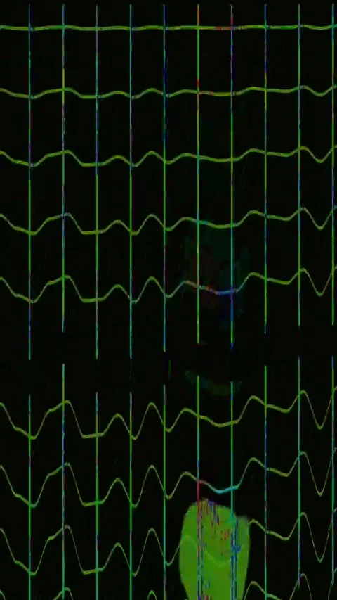 Bad TV Glitch 4K Vertical Seamless — Abstract VJ Overlay Loop Stock Footage 329679725
