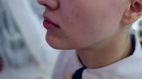 Bald Girl in Hospital Stock Footage 59666847