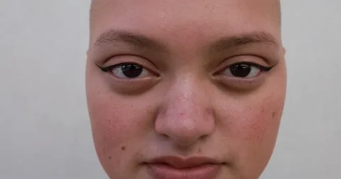 Bald girl looking on camera - Real people, diversity and female power concept Видео 161066960