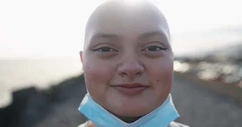 Bald girl smiling on camera while wearing safety face mask under chin Stock Footage 161067153