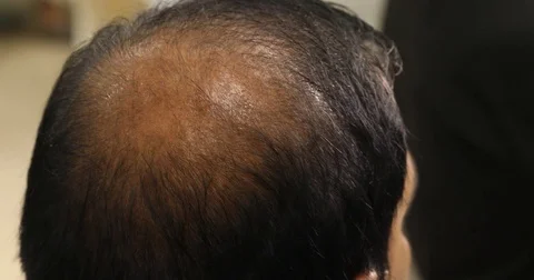 Bald head man Stock Footage 83786353