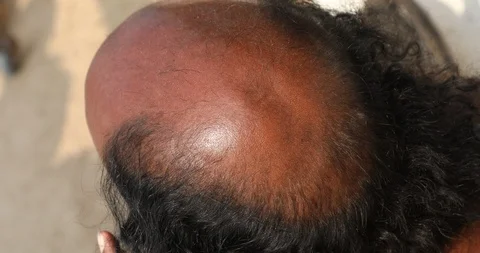 Bald head man Stock Footage 86568120