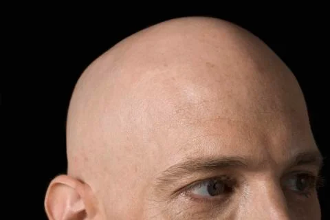 Bald head of a man Stock Photos