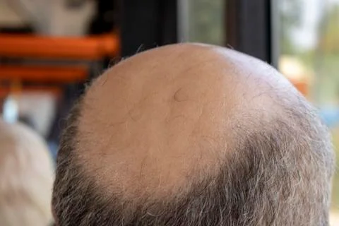 Bald head. Stock Photos
